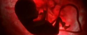 Child-